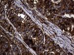 SKIL Antibody in Immunohistochemistry (Paraffin) (IHC (P))