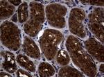 SKIL Antibody in Immunohistochemistry (Paraffin) (IHC (P))