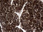 SKIL Antibody in Immunohistochemistry (Paraffin) (IHC (P))