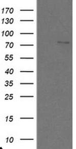 SKIL Antibody in Western Blot (WB)