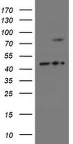 SKIL Antibody in Western Blot (WB)