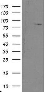 SKIL Antibody in Western Blot (WB)