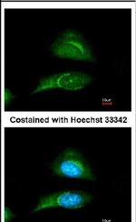 SKIP Antibody in Immunocytochemistry (ICC/IF)