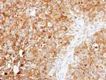 SKIP Antibody in Immunohistochemistry (IHC)