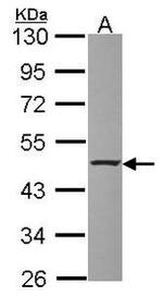 SKIP Antibody in Western Blot (WB)