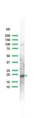 SKP1 Antibody in Western Blot (WB)