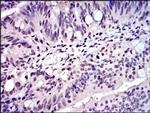 SKP1 Antibody in Immunohistochemistry (Paraffin) (IHC (P))