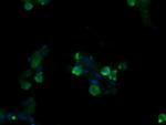 SLA2 Antibody in Immunocytochemistry (ICC/IF)