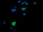 SLA2 Antibody in Immunocytochemistry (ICC/IF)