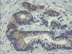 SLA2 Antibody in Immunohistochemistry (Paraffin) (IHC (P))