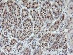 SLA2 Antibody in Immunohistochemistry (Paraffin) (IHC (P))