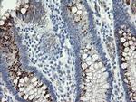SLA2 Antibody in Immunohistochemistry (Paraffin) (IHC (P))