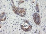 SLA2 Antibody in Immunohistochemistry (Paraffin) (IHC (P))