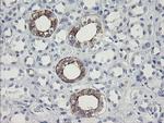 SLA2 Antibody in Immunohistochemistry (Paraffin) (IHC (P))