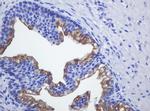 SLA2 Antibody in Immunohistochemistry (Paraffin) (IHC (P))