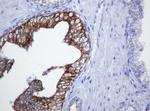 SLA2 Antibody in Immunohistochemistry (Paraffin) (IHC (P))