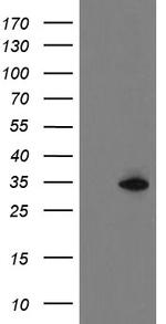 SLA2 Antibody in Western Blot (WB)