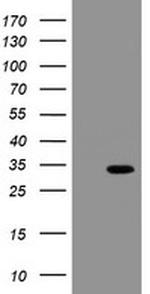 SLA2 Antibody in Western Blot (WB)