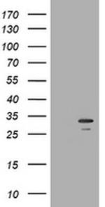 SLA2 Antibody in Western Blot (WB)