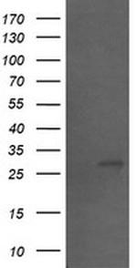 SLA2 Antibody in Western Blot (WB)