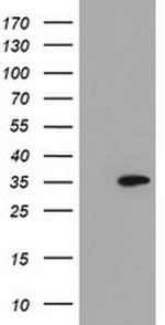 SLA2 Antibody in Western Blot (WB)