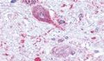 MCHR1 Antibody in Immunohistochemistry (Paraffin) (IHC (P))