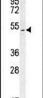 SLC10A4 Antibody in Western Blot (WB)