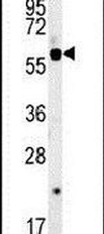 SLC16A9 Antibody in Western Blot (WB)