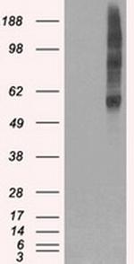 SLC18A2 Antibody in Western Blot (WB)