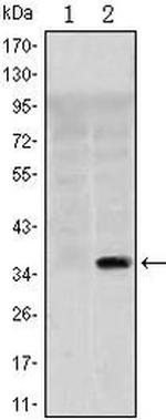 SLC22A1 Monoclonal Antibody (2C5)