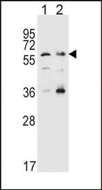 SLC22A4 Antibody in Western Blot (WB)