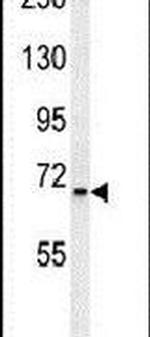 SLC25A12 Antibody in Western Blot (WB)