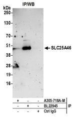 SLC25A46 Polyclonal Antibody