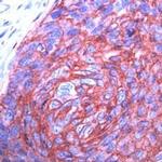 GLUT1 Antibody in Immunohistochemistry (IHC)