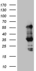 SLC2A4RG Antibody in Western Blot (WB)