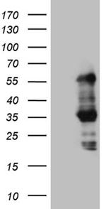 SLC2A4RG Antibody in Western Blot (WB)