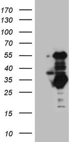 SLC2A4RG Antibody in Western Blot (WB)