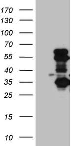 SLC2A4RG Antibody in Western Blot (WB)