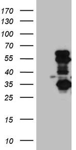 SLC2A4RG Antibody in Western Blot (WB)