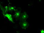 SLC2A5 Antibody in Immunocytochemistry (ICC/IF)