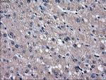 SLC2A5 Antibody in Immunohistochemistry (Paraffin) (IHC (P))