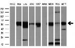 SLC2A5 Antibody in Western Blot (WB)