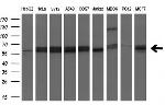 SLC2A6 Antibody in Western Blot (WB)