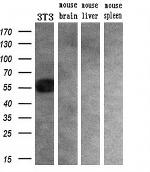 SLC2A6 Antibody in Western Blot (WB)