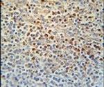 SLC4A7 Antibody in Immunohistochemistry (IHC)