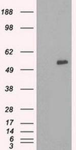 SLC7A8 Antibody in Western Blot (WB)