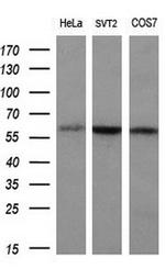 SLC7A8 Antibody in Western Blot (WB)