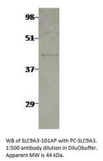 Sodium/Hydrogen Exchanger 3 Antibody in Western Blot (WB)