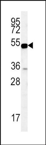 EBP50 Antibody in Western Blot (WB)