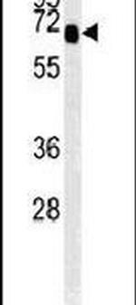 SLC9A9 Antibody in Western Blot (WB)